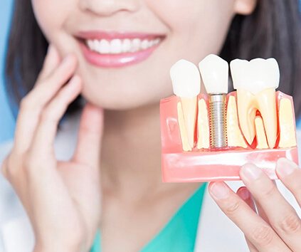 Dental İmplant Fiyat