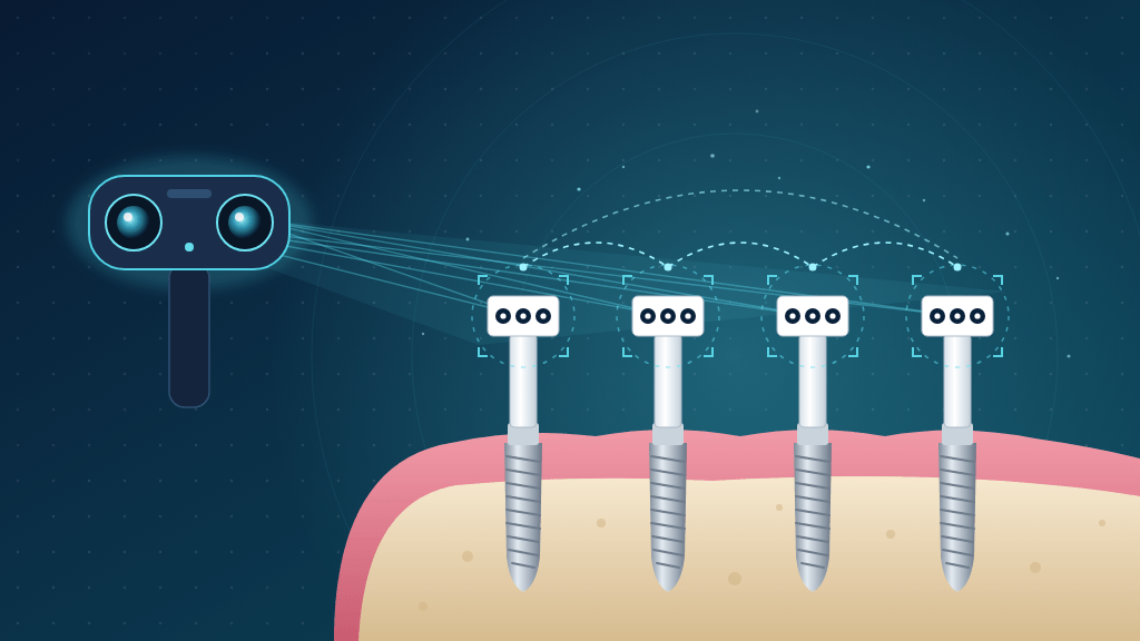 Fotogrametri ile implant ölçüsü